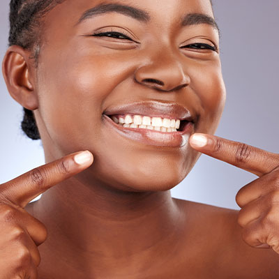 veneers